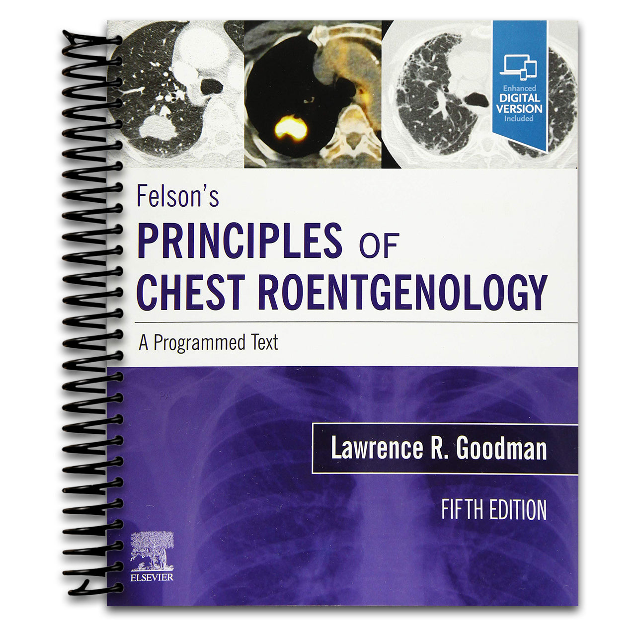 Felson's Principles of Chest Roentgenology, A Programmed Text: A Programmed Text (Spiral bound)