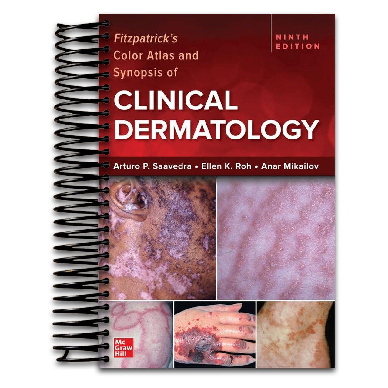 Fitzpatrick's Color Atlas and Synopsis of Clinical Dermatology, Ninth Edition