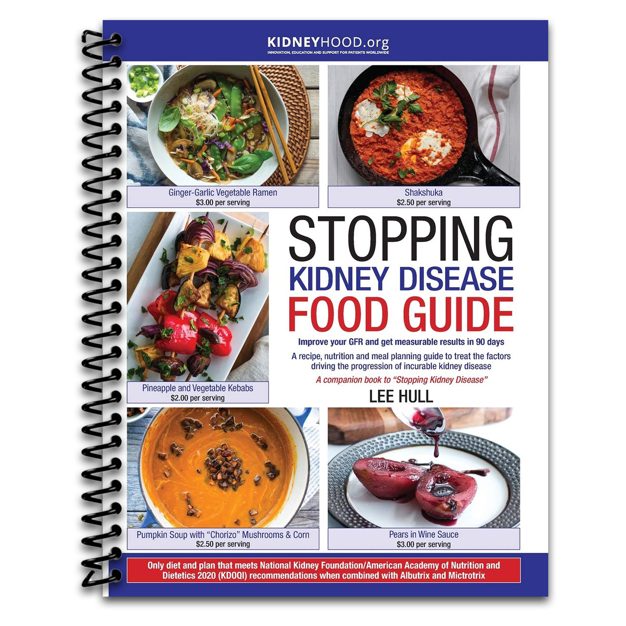 Stopping Kidney Disease Food Guide: A recipe, nutrition and meal planning guide to treat the factors driving the progression of incurable kidney disease