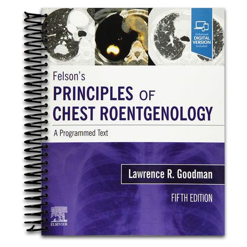 Felson's Principles of Chest Roentgenology, A Programmed Text: A Programmed Text   (Spiral bound)