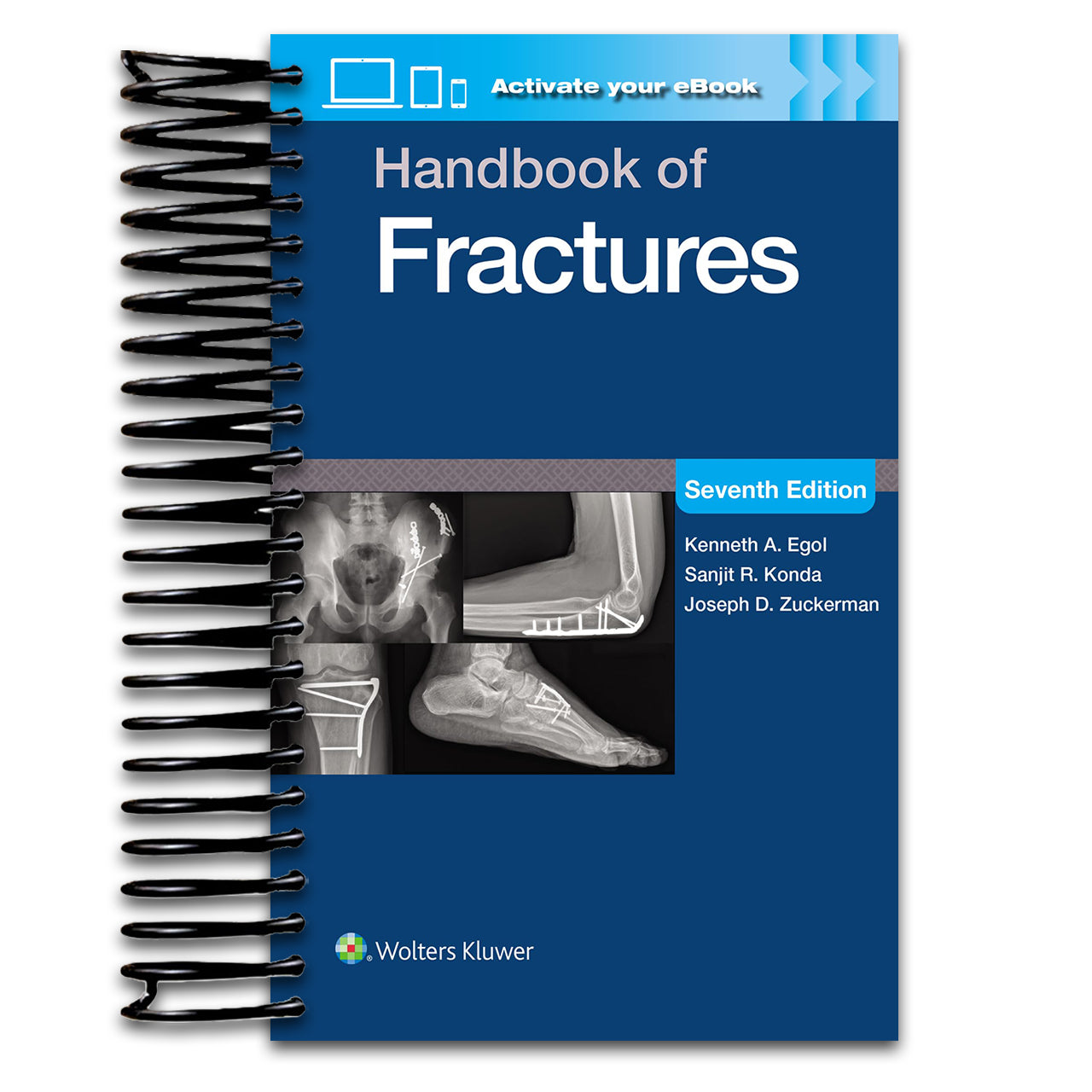 Handbook of Fractures: Print + eBook with Multimedia (Spiral bound) Happy Coil spiral bound book