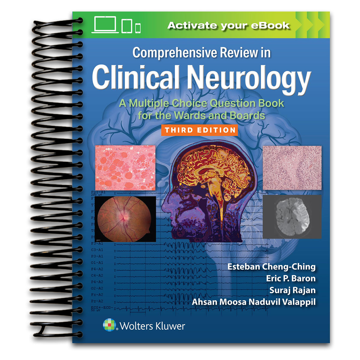 Comprehensive Review in Clinical Neurology: A Multiple Choice Question Book for the Wards and Boards Print + Ebook with Multimedia   (Spiral bound)